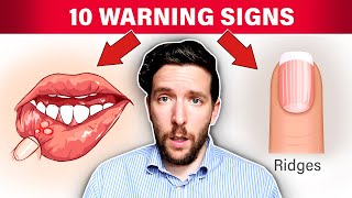 10 WARNING Signs That Your Stomach Acid Is Low [upl. by Atsyrc371]