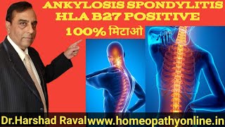 Hla b27 positive क्या है और उसका होमेओपेथी उपचार l Dr harshad Raval MD Homeopath [upl. by Harrak]