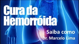 HEMORROIDA  CONHEÇA O TRATAMENTO Dr Marcelo Lima [upl. by Old]