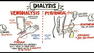 Failing Kidneys and Different Treatment Options [upl. by Ramburt]