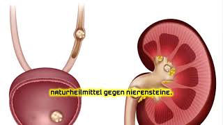 Naturheilmittel gegen Nierensteine [upl. by Rehpotsirc887]