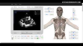 LVOT AND RVOT LINEAR MEASUREMENTS [upl. by Acey]