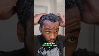 DAY 127 TRYING TO GROW MY HAIRLINE IN ‼️🧔🏾‍♂️ [upl. by Ilhsa]