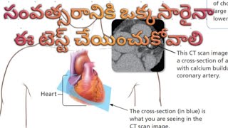 30 సంవత్సరాలు దాటిన ప్రతి ఒక్కరూ సంవత్సరానికి ఒక్కసారైనా ఈ టెస్ట్ చేయించుకోవాలి CAC SCORE TEST [upl. by Madigan]