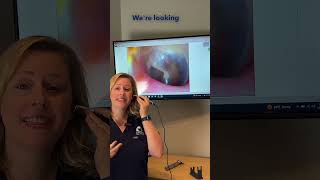 Checking Your Ears with Video Otoscopy [upl. by Ayenat470]