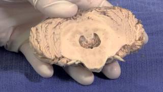 The Cerebellum Neuroanatomy Video Lab  Brain Dissections [upl. by Akialam989]