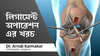 লিগামেন্ট অপারেশন এর খরচ Knee Ligament Surgery Cost in India Knee Arthroscopy Cost in Kolkata [upl. by Ahsinuq585]