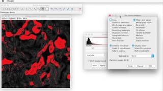 FIJI for Quantification Area of Stain [upl. by Placida611]