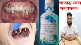 Doc Clean Mouthwash Chlorhexidine Gluconate Sodium Fluoride amp Zinc Chloride Oral Rinse [upl. by Roach]