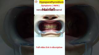 Hypoparathyroidism symptoms in hindi  shorts shortsfeeds [upl. by Lipski816]