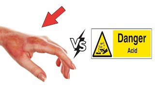 How much harm does acid do to humans [upl. by Link]