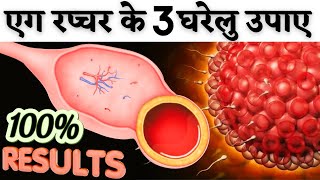 एग रप्चर के 3 घरेलू उपाय करिए प्रेगनेंसी ज़रूर होगी  Egg rupture tips  Youtube Saheli [upl. by Hooker]