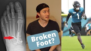 Lisfranc Injuries in the NFL  Travis Etiennes Foot [upl. by Nomannic]