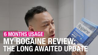 MY ROGAINE EXPERIENCE 6 Months On Has My Hair Grown Back [upl. by Mattland]