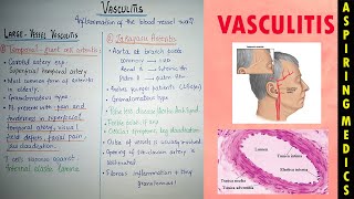 Vasculitis pathology lecture part 1Temporal giant cell and takayasus arteritis Aspiring medics [upl. by Gona]