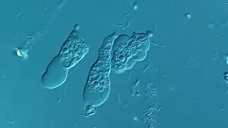 Amoeba under microscope [upl. by Suiluj957]