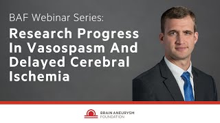 Research Progress In Vasospasm And Delayed Cerebral Ischemia [upl. by Rowan848]