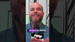 Tipos de prótesis dentales shortsvideo [upl. by Defant59]