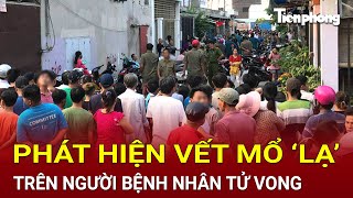 Bản tin thời sự  Phát hiện vết mổ ‘lạ’ trên người bệnh nhân tử vong Công an khẩn cấp vào cuộc [upl. by Ettelimay]