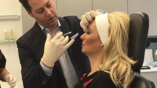 Dr Eric Schweiger performing Botox injections on Mary Sciarrone of Cake Boss [upl. by Wynnie]