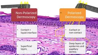 Principles of Dermoscopy  Dr Natalia Jaimes [upl. by Asselim]