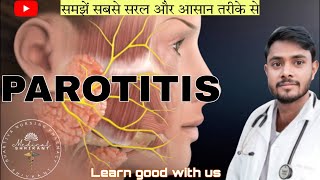 Parotitis  parotitis in hindi  paroted gland swelling  paroted gland or salivary gland infection [upl. by Schiffman]