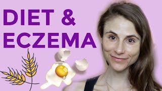 DIET amp SUPPLEMENTS FOR ECZEMA QampA WITH DERMATOLOGIST DR DRAY [upl. by Eirahcaz185]