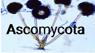 Ascomycota Advance Knowledge 1st year biology [upl. by Jorgenson]