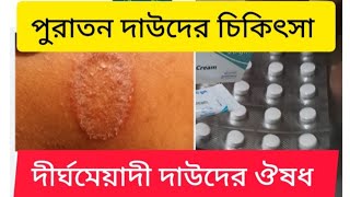 পুরাতন দাউদের চিকিৎসা  দীর্ঘমেয়াদি দাউদের ঔষধ  Ringworm treatment [upl. by Eeniffar]