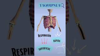 Polipnea vs Taquipnea [upl. by Pruter485]