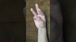 Palmaris lungas Muscle [upl. by Iatnwahs]