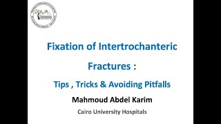 Fixation of Intertrochanteric Fractures Tips  Tricks amp Avoiding Pitfalls [upl. by Burkhardt]