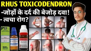 Rhus Tox 200 Homeopathic Medicine uses  Rhus Toxicodendron 30 uses in Hindi [upl. by Aridatha]