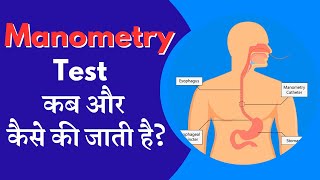 Manometry test कब और कैसे की जाती है   What is Manometry Test  Dr Zubin Dev Sharma  Hindi [upl. by Eniaral924]