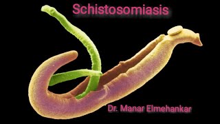 Schistosomiasis Dr Manar Elmehankar Schistosomiasis Schistosomahaematobium Schistosomamansoni [upl. by Isyed368]