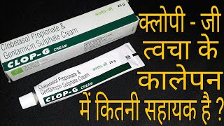 Clop  G Cream त्चचा के कालेपन को 100 मिटाता है [upl. by Tiertza]