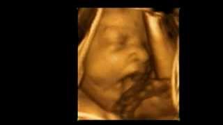 3D Ultrasound 30 weeks Yawning baby A New Conception 3D [upl. by Pia]