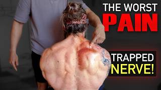 The WORST PAIN ❗️ Releasing TRAPPED MUSCLE NERVE After 4 YEARS Motorbike Injury Fixed [upl. by Waldemar]