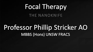 Focal Therapy The Nanoknife [upl. by Ahsatniuq686]