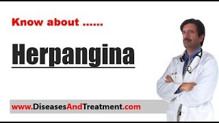 Herpangina  Causes Diagnosis Symptoms Treatment [upl. by Norrat]