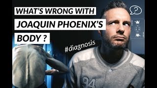 The Real Diagnosis of Joaquin Phoenixs Body in Joker french w english subtitles [upl. by Ruskin]