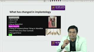 FREE ONLINE COURSE ON CORTICO BASAL IMPLANTOLOGY [upl. by Yentyrb481]