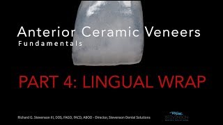 Anterior Ceramic Veneers Part 4 Lingual Wrap [upl. by Yrod]