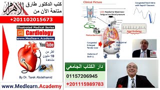 Constrictive Pericarditis cme internalmedicine medical usmle محاضراتباطنة [upl. by Trofmoc440]