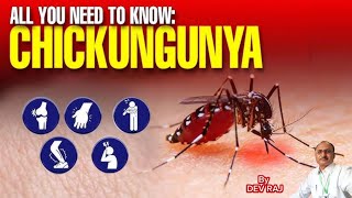 Chikungunya viral infectionFever Joint pain Mosquito 🦟 bite diseaseچکنگونیا [upl. by Daas110]