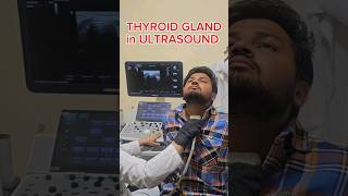 THYROID GLAND ULTRASOUND VIEW ☢️ ultrasound sonography thyroid thyroxine radiology mbbs [upl. by Aleetha]