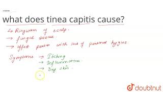 what does tinea capitis cause [upl. by Hayden]