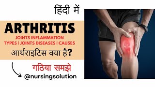 Arthritis in hindi  Joints inflammation in hindi  Types of arthritis  Causes  Symptoms [upl. by Wilhelm]