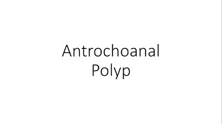 Antrochoanal Nasal Polyp  ENT [upl. by Robinson746]