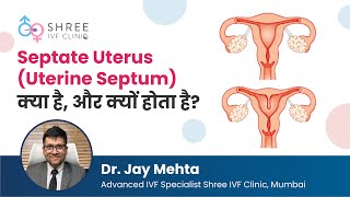 Septate Uterus Uterine Septum क्या है और क्यों होता है  Dr Jay Mehta [upl. by Gil]